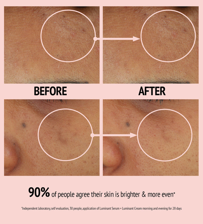 Close-up comparison of facial skin before and after using Luminant Cream | [ comfort zone ], showing visibly brighter and more even skin tone with reduced discoloration.