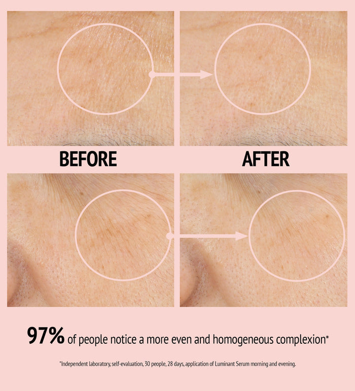 Close-up comparison of skin texture before and after using Luminant Serum | [ comfort zone ], showing improved evenness and smoother complexion in skincare results.